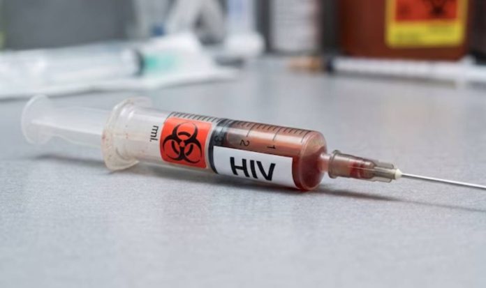 hiv